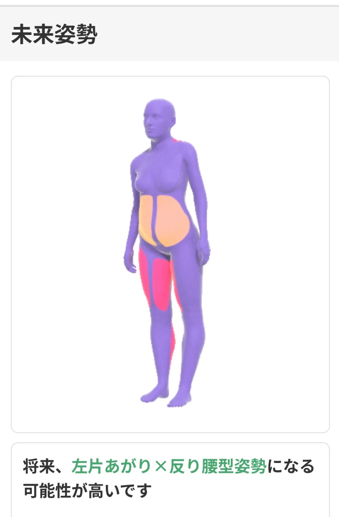 パーソナルジムでAI姿勢分析を活用するメリットとデメリット徹底解説